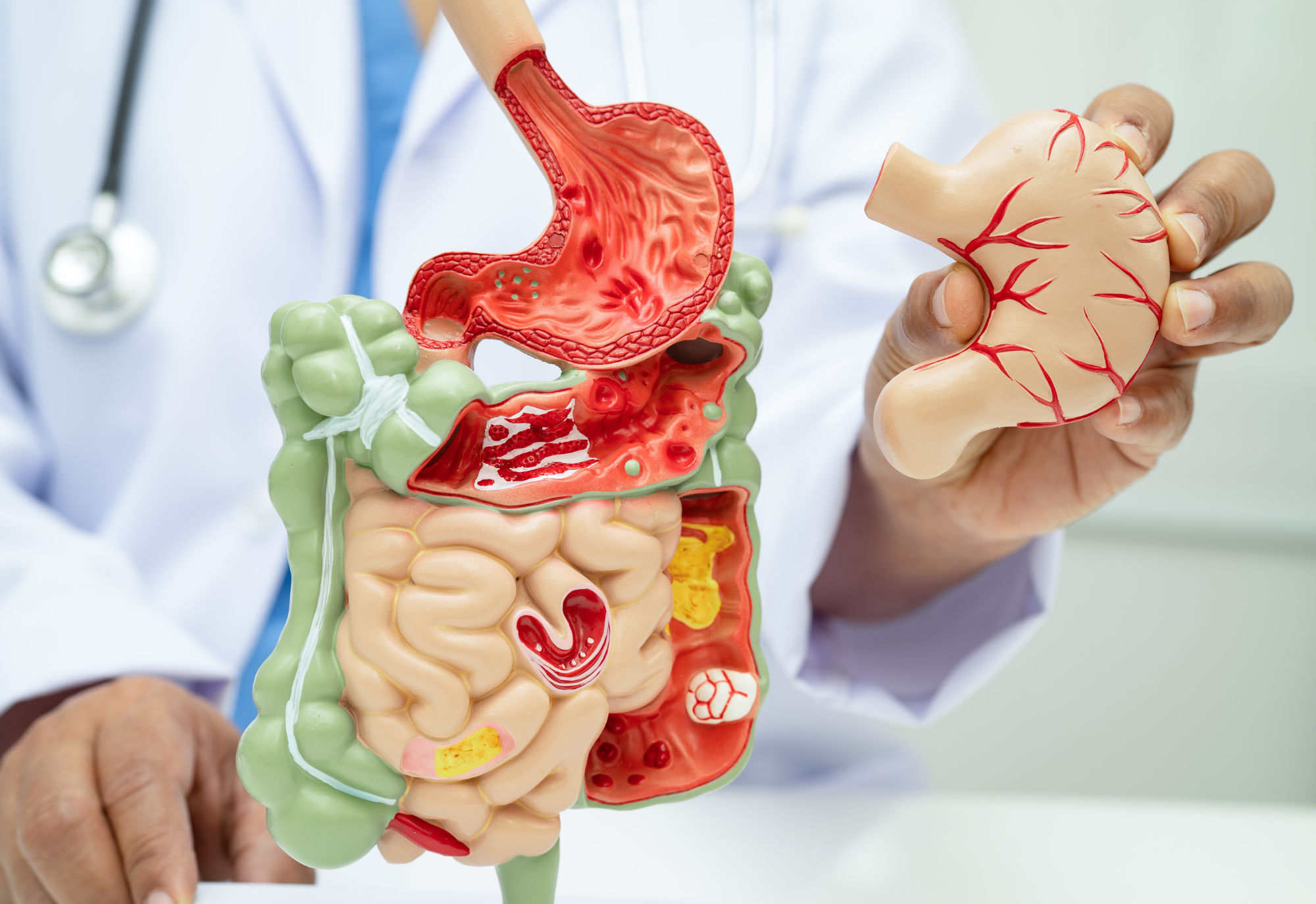 apa itu gut health dan kenapa penting untuk tubuh