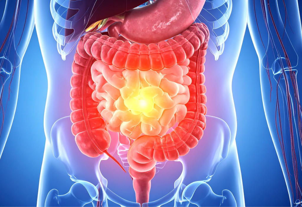 gut health untuk pencernaan lebih dari sekadar bab lancar