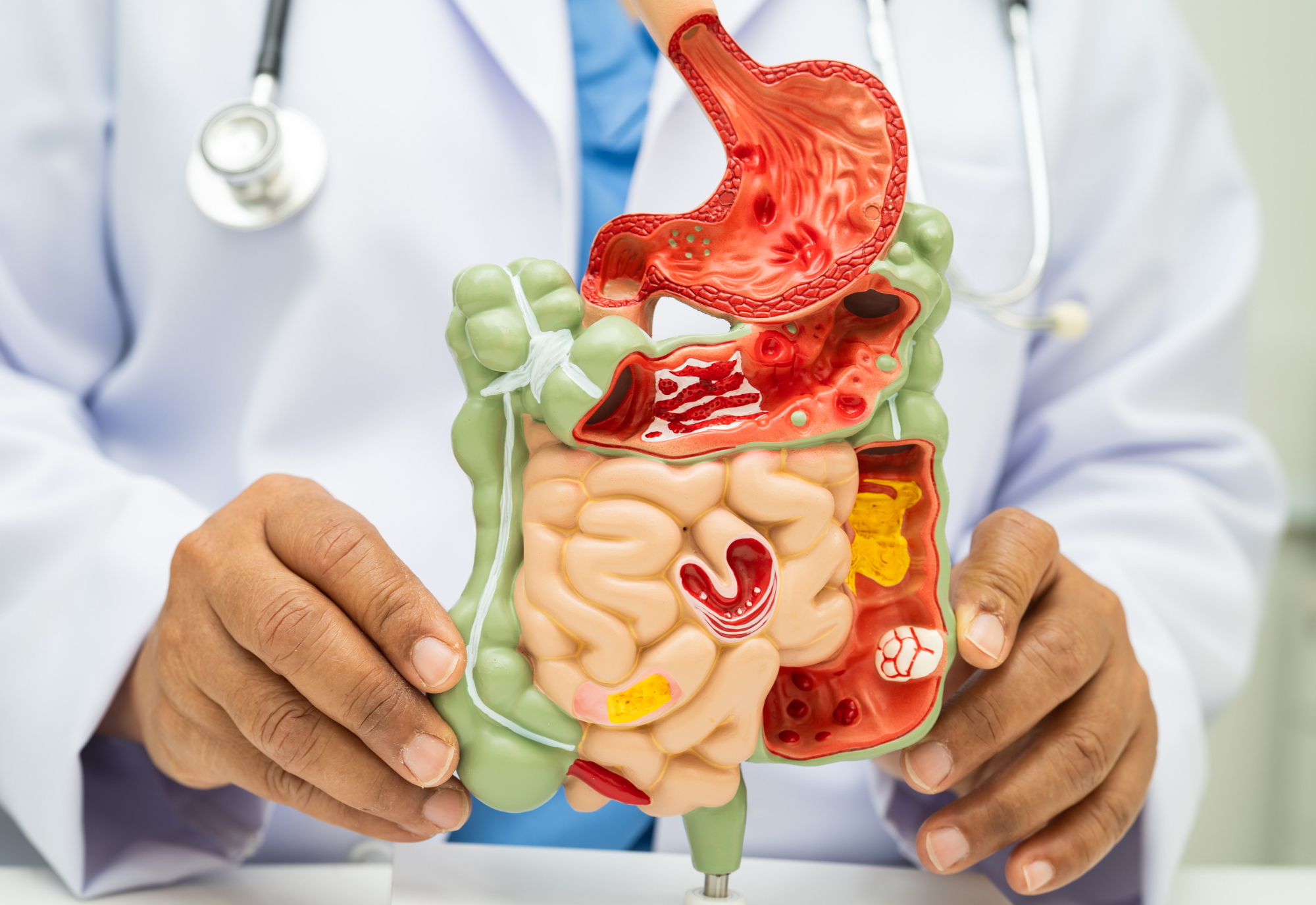 tanda tanda gut health kamu bermasalah